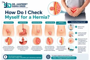 How Do I Check Myself for a Hernia