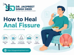 How to Heal Anal Fissure in Sharjah